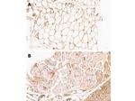 ZO-1 Antibody in Immunohistochemistry (Paraffin) (IHC (P))