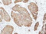 Ire1 Antibody in Immunohistochemistry (IHC)