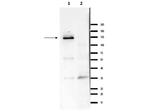 Ire1 Antibody in Western Blot (WB)