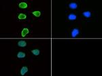 H3K9me3 Antibody in Immunocytochemistry (ICC/IF)