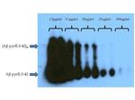 beta Amyloid pyro E3 Antibody in Western Blot (WB)