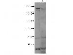 Huntington Antibody in Western Blot (WB)