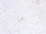 p35 Antibody in Immunohistochemistry (IHC)