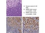 MMP2 Antibody in Immunohistochemistry (IHC)