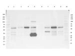 MMP2 Antibody in Western Blot (WB)