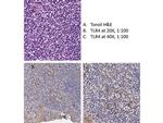 TLR4 Antibody in Immunohistochemistry (IHC)