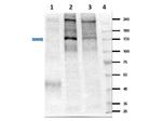 Phospho-Insulin Receptor (Tyr1361) Antibody in Western Blot (WB)