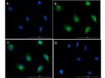 Phospho-SMAD2 (Ser467) Antibody in Immunocytochemistry (ICC/IF)