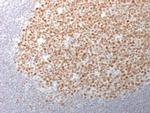 Bcl-6 Antibody in Immunohistochemistry (Paraffin) (IHC (P))