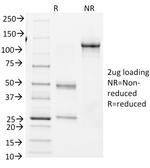 Bcl-6 Antibody in SDS-PAGE (SDS-PAGE)