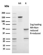 Bcl-6 (Follicular Lymphoma Marker) Antibody in SDS-PAGE (SDS-PAGE)