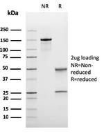 Bcl-6 (Follicular Lymphoma Marker) Antibody in SDS-PAGE (SDS-PAGE)