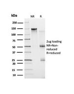 BCL6 Antibody in Immunoelectrophoresis (IE)