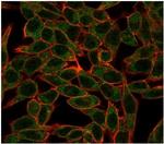 BCL6 Antibody in Immunocytochemistry (ICC/IF)