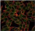 BCL6 Antibody in Immunocytochemistry (ICC/IF)