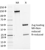 Bcl-6 (Follicular Lymphoma Marker) Antibody in SDS-PAGE (SDS-PAGE)