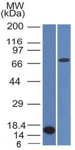 Bcl-6 (Follicular Lymphoma Marker) Antibody in Western Blot (WB)