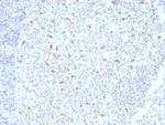 Bcl-6 (Follicular Lymphoma Marker) Antibody in Immunohistochemistry (Paraffin) (IHC (P))