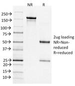 Bcl-6 (Follicular Lymphoma Marker) Antibody in SDS-PAGE (SDS-PAGE)