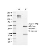 Bcl-6 (Follicular Lymphoma Marker) Antibody in SDS-PAGE (SDS-PAGE)