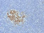 Bcl-6 Antibody in Immunohistochemistry (Paraffin) (IHC (P))