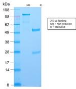 Bcl-6 Antibody in SDS-PAGE (SDS-PAGE)