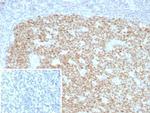 Bcl-6 (Follicular Lymphoma Marker) Antibody in Immunohistochemistry (Paraffin) (IHC (P))