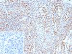 Bcl-6 (Follicular Lymphoma Marker) Antibody in Immunohistochemistry (Paraffin) (IHC (P))