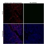 Ki-67 Antibody in Immunohistochemistry (Paraffin) (IHC (P))