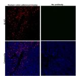 Ki-67 Antibody in Immunohistochemistry (Paraffin) (IHC (P))