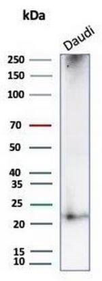 CD269/TNFRSF17/BCMA (B-Cell Maturation Protein) Antibody in Western Blot (WB)