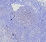 CD269/TNFRSF17/BCMA (B-Cell Maturation Protein) Antibody in Immunohistochemistry (Paraffin) (IHC (P))