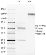 ROR-gamma/RORC (RAR-related Orphan Receptor C) Antibody in SDS-PAGE (SDS-PAGE)