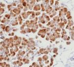 ROR-gamma/RORC (RAR-related Orphan Receptor C) Antibody in Immunohistochemistry (Paraffin) (IHC (P))