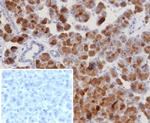 ROR-gamma/RORC (RAR-related Orphan Receptor C) Antibody in Immunohistochemistry (Paraffin) (IHC (P))