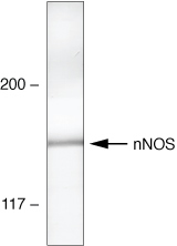 nNOS Antibody in Western Blot (WB)