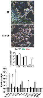 IL-17A Antibody in Immunocytochemistry (ICC/IF)