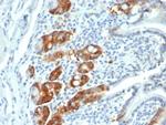 Ribonucleotide Reductase M1/RRM1 Antibody in Immunohistochemistry (Paraffin) (IHC (P))