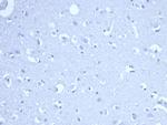 Ribonucleotide Reductase M1/RRM1 Antibody in Immunohistochemistry (Paraffin) (IHC (P))