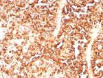 S100A1 (Melanoma Marker) Antibody in Immunohistochemistry (Paraffin) (IHC (P))