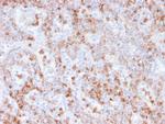 Calprotectin/MRP14/S100A9/Calgranulin B Antibody in Immunohistochemistry (Paraffin) (IHC (P))