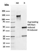 Calprotectin/MRP14/S100A9/Calgranulin B Antibody in SDS-PAGE (SDS-PAGE)