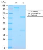 S100A9 + Calprotectin (S100A8/A9 Complex) Antibody in SDS-PAGE (SDS-PAGE)