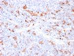 S100A9 + Calprotectin (S100A8/A9 Complex) Antibody in Immunohistochemistry (Paraffin) (IHC (P))