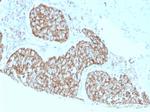 Calprotectin/MRP14/S100A9/Calgranulin B Antibody in Immunohistochemistry (Paraffin) (IHC (P))