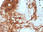 Calprotectin/MRP14/S100A9/Calgranulin B Antibody in Immunohistochemistry (Paraffin) (IHC (P))