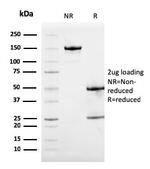 Calprotectin/MRP14/S100A9/Calgranulin B Antibody in SDS-PAGE (SDS-PAGE)