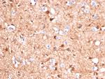 S100B (Astrocyte and Melanoma Marker) Antibody in Immunohistochemistry (Paraffin) (IHC (P))