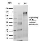 S100B (Astrocyte and Melanoma Marker) Antibody in SDS-PAGE (SDS-PAGE)