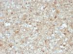 S100B (Astrocyte and Melanoma Marker) Antibody in Immunohistochemistry (Paraffin) (IHC (P))